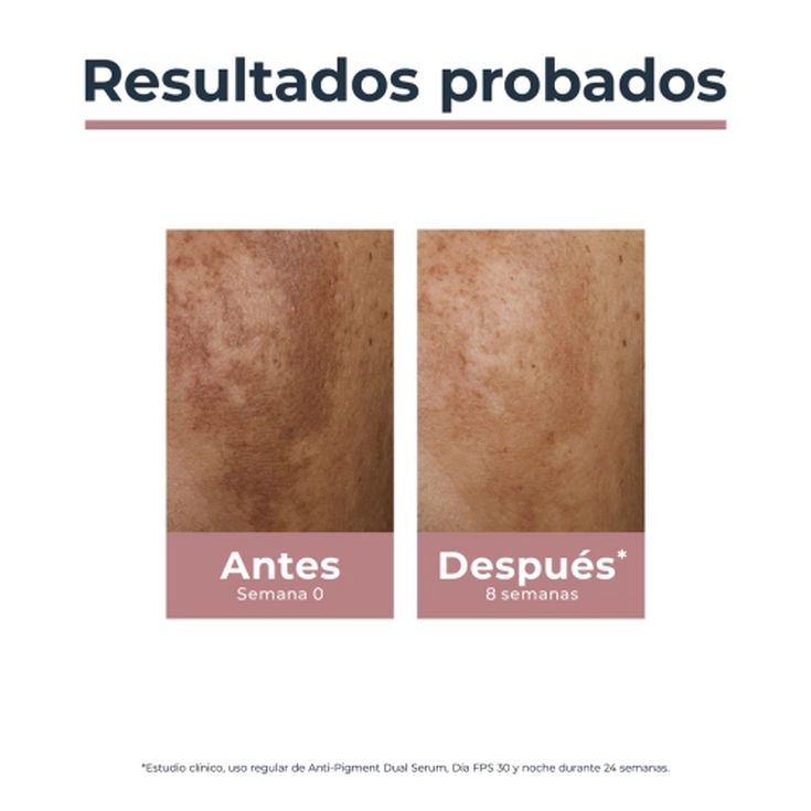 eucerin anti-pigment crema dia spf30 50 ml