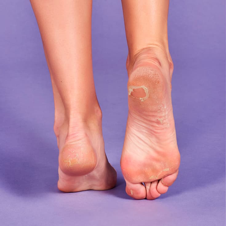 iroha calcetines mascarilla para pies exfoliacion lavanda
