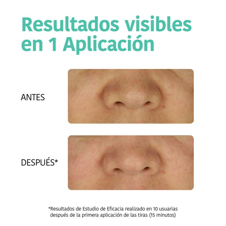 iroha tiras limpieza detox puntos negros nariz