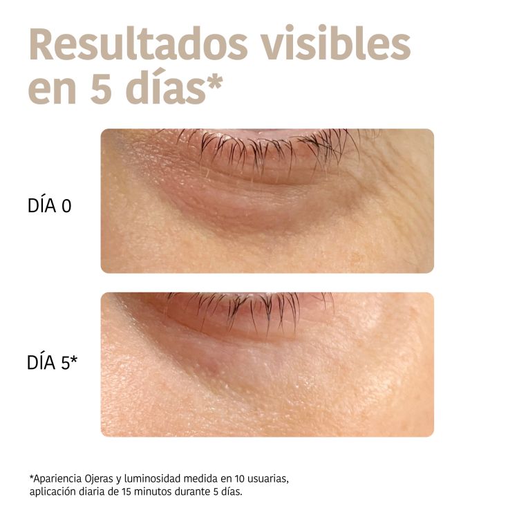 iroha nature parches contorno de ojos cuidado global 2 uds