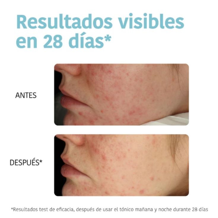 iroha nature discos tonico exfoliantes 50 ud
