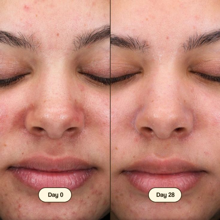 freshly c.limpiador facial salicylic 100 ml