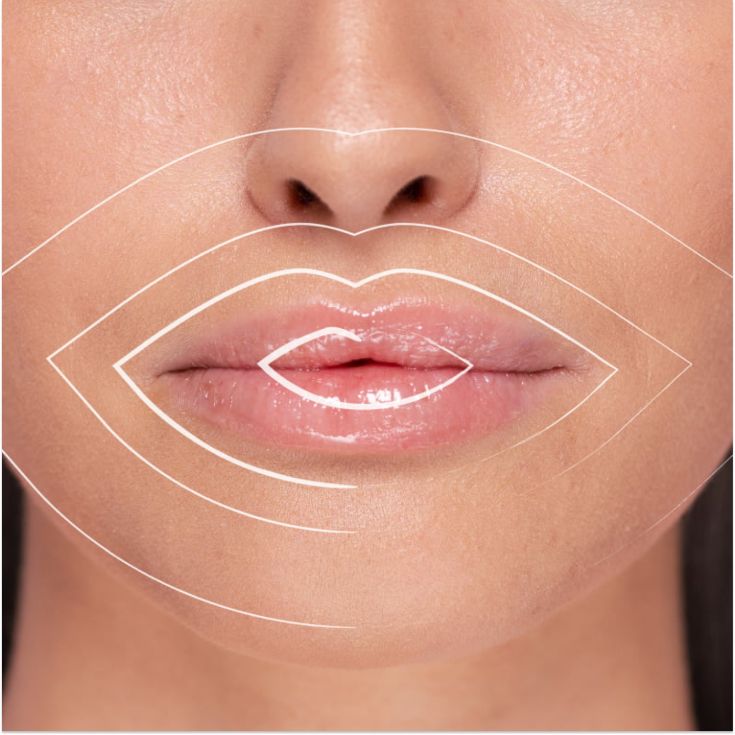 freshly voluminizador labios hyaluronic 5ml