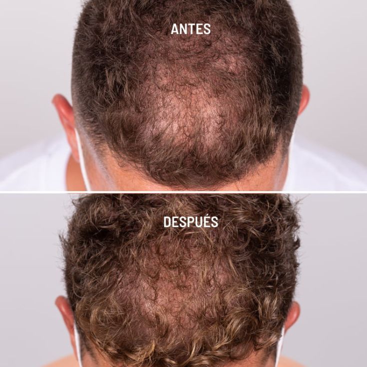 freshly cosmetics hair growth & density treatment