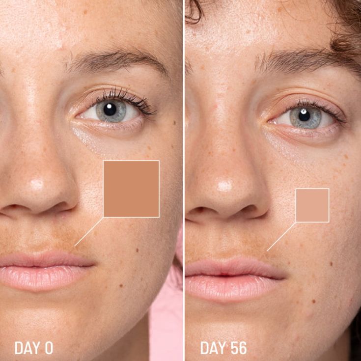 freshly cosmetics lotus radiance darkspot treatment 