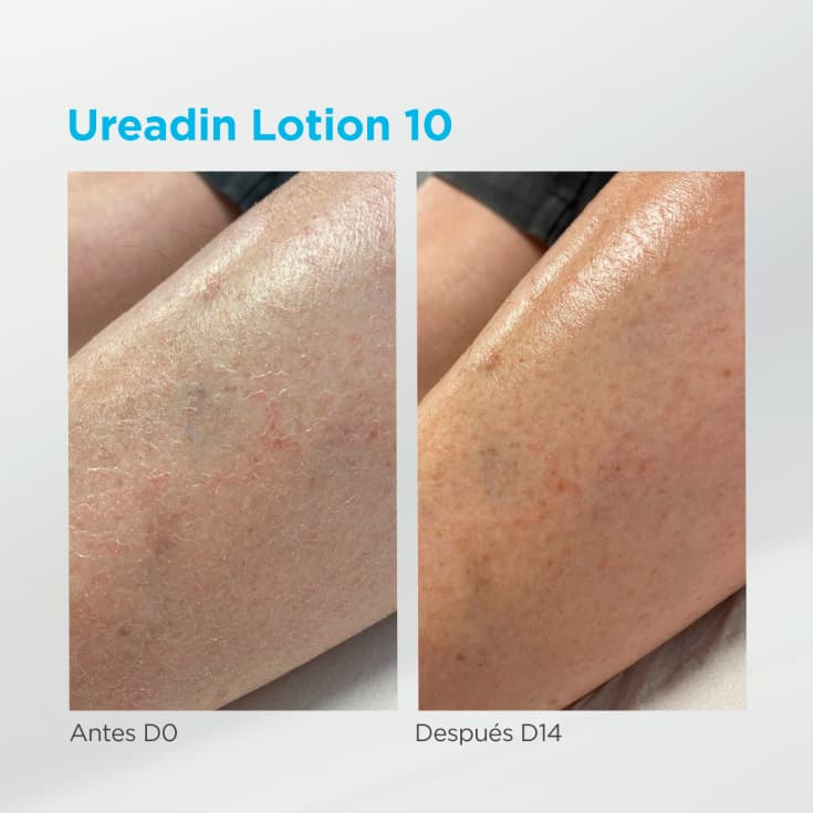 isdin ureadin lotion10 hidratacion intensa