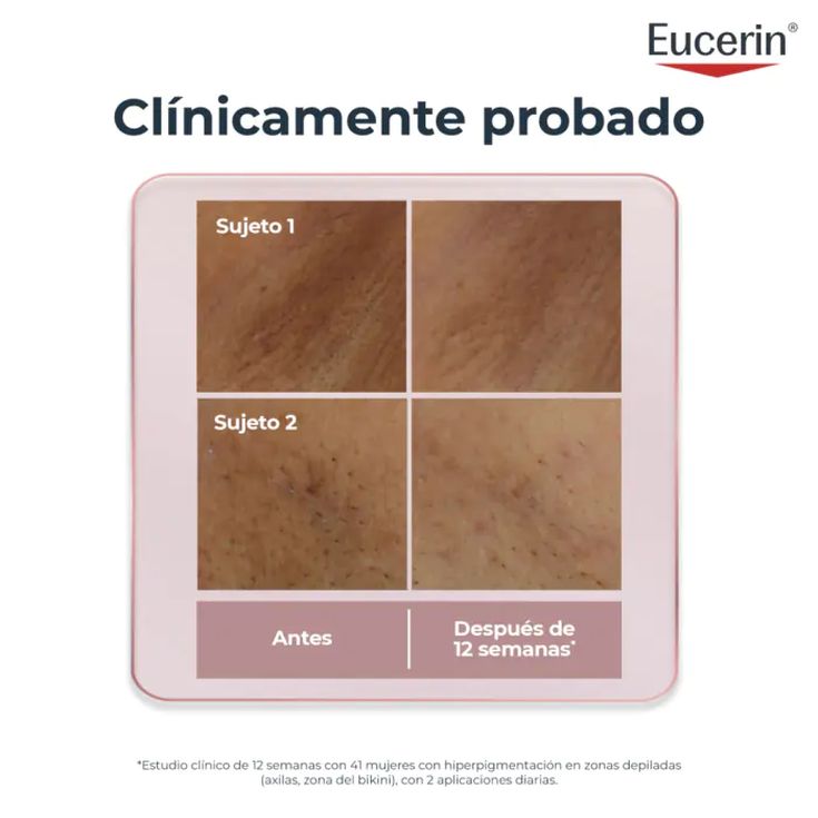 eucerin anti-pigment body serum corporal 75ml eucerin anti-pigment body serum corporal 75ml