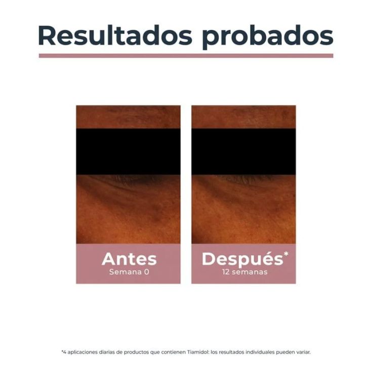 eucerin contorno de ojos anti-pigment 15ml eucerin contorno de ojos anti-pigment 15ml