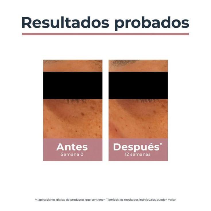 eucerin contorno de ojos anti-pigment 15ml eucerin contorno de ojos anti-pigment 15ml