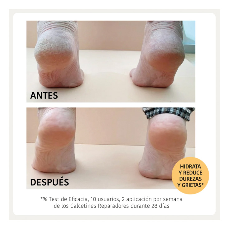 iroha calcetines mascarilla repararadora melocoton