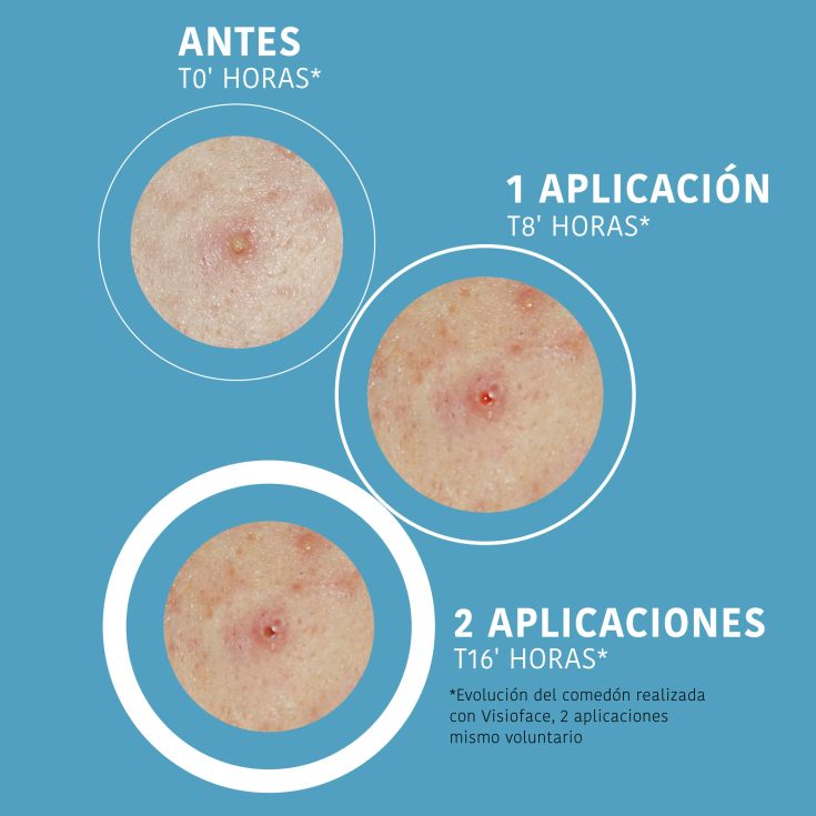 iroha nature parches sos granos