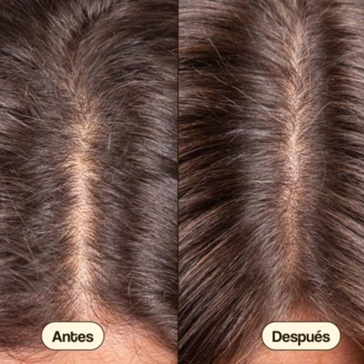 freshly tratamiento capilar crecimiento y densidad 50ml freshly tratamiento capilar crecimiento y densidad 50ml