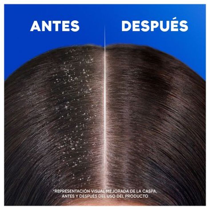 h&s champu anticaspa classic 95ml